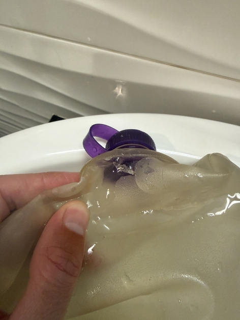 bladder failure